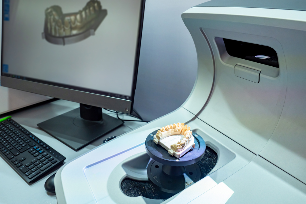 CAD/CAM digital dental scanning technology Dental lab scanner capturing a digital impression for dentists in the San Fernando Valley community